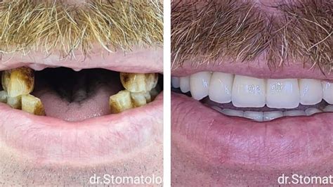 Stomatologie Chisinau Botanica Terradent Moldova Pun I Dentare Pe