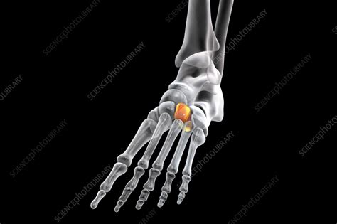 Lateral cuneiform bone, illustration - Stock Image - F036/8578 - Science Photo Library