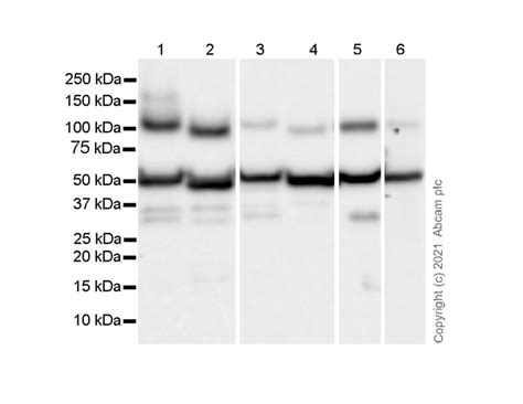 Fibrinogen Gamma Chain Ep Fibrinogen Gamma Chain Ab