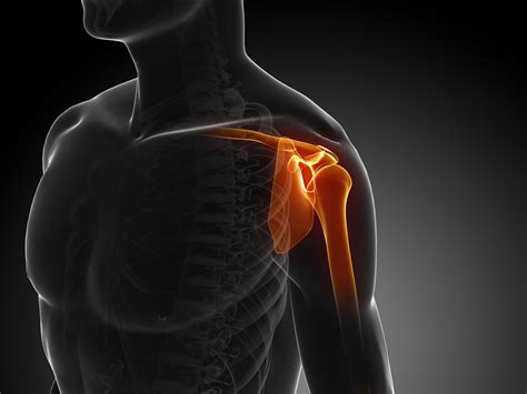 Shoulder Impingement Treatment | Burlington Physiotherapy Clinic