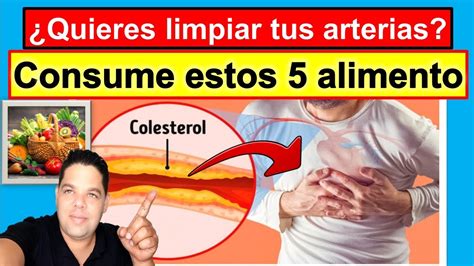 Quieres Limpiar Tus Arterias Consume Estos Alimentos Youtube