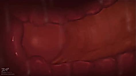 Braixen Videos XVIDEOS