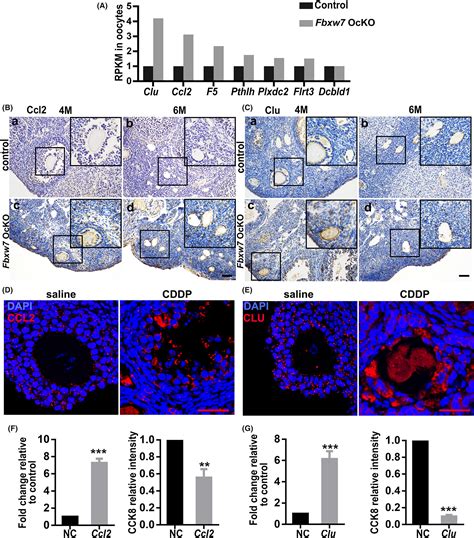 Deletion Of Fbxw In Oocytes Causes Follicle Loss And Premature Ovarian