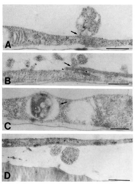 Transmission Electron Micrographs Show Interactions Between Bovine