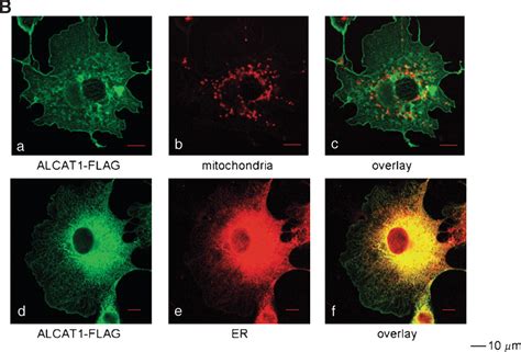 The Microsomal Cardiolipin Remodeling Enzyme Acyl Coa Lysocardiolipin