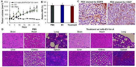 In Vivo Anti Tumor Efficacy Of Mab Ev Ver A In Tnbc Pdx Models A