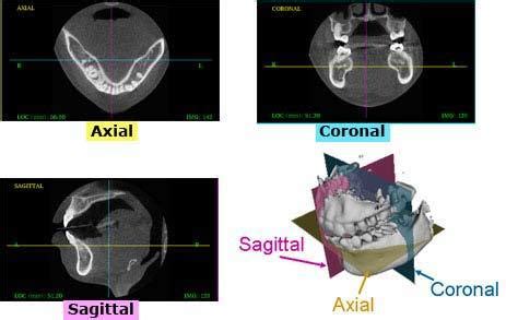 Axial, coronal and sagittal view | Download Scientific Diagram