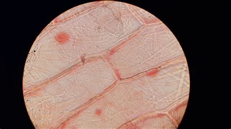 Onion Cell Under Microscope Labeled Diagram