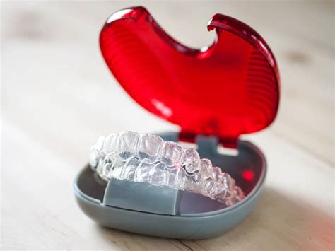 What Are Invisalign Attachments?