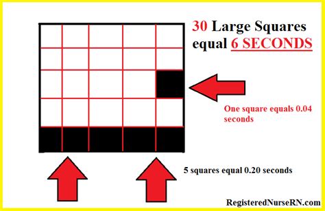 33 Calculating Rate Ecg Sheikhkiara