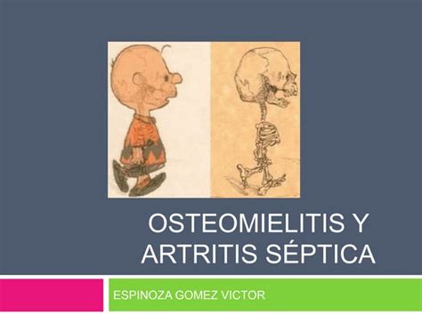 Osteomielitis Artritis Séptica Y Sinovitis En Pediatría Ppt