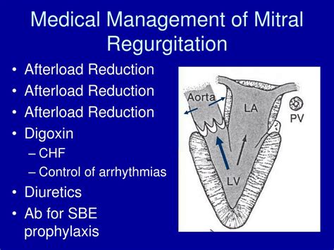 Management Of Mitral Regurgitation