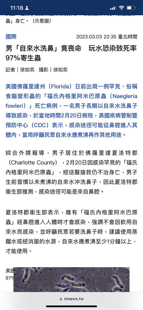 新聞 獨／北部女染食腦蟲亡 室內親水館業者不解：其他人也天天泡水 Ptt Hito