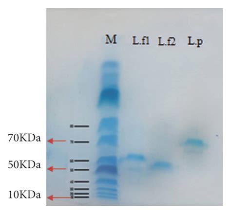 Bacteriocins isolated from two strains of Lactobacillus fermentum (L.f1 ...