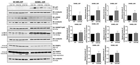 Ijms Free Full Text 2 Methoxyestradiol 317 Oo Bis Sulfamate