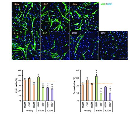 Attenuated Myogenic Differentiation Of Dm Myoblasts Representative Download Scientific