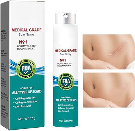 South Moon Medical Grade Scar Spray Scar Removal Advanced Scar Spray