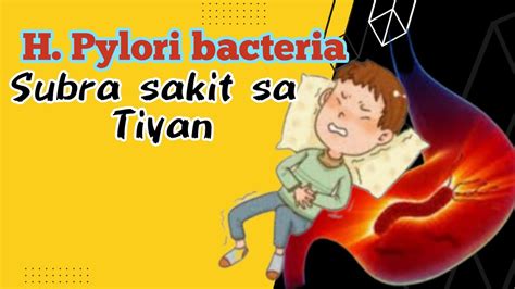 Paano Gamutin Ang H Pylori Bacteria Na Subrang Sakit Sa Tiyan YouTube