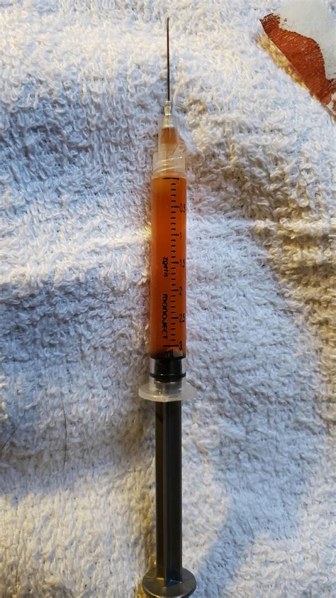Excess Fluid Removed from Right Nut : r/stirringcastration