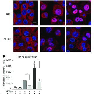 Neutrophil Elastase NE Degrades TNF IL 6 And IL 8 A