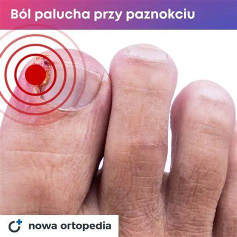 Ból Dużego Palca W Stopie Ból Stawu Palucha Przyczyny Szpital Dworska