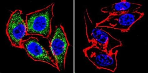 Enos Antibody Pa3 031a