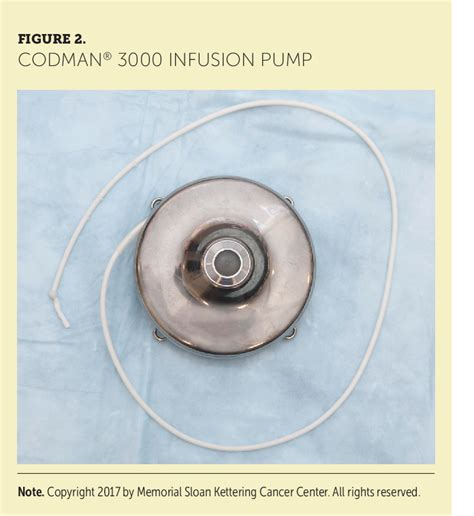 Figure From Hepatic Arterial Infusion Pump Complications And Nursing