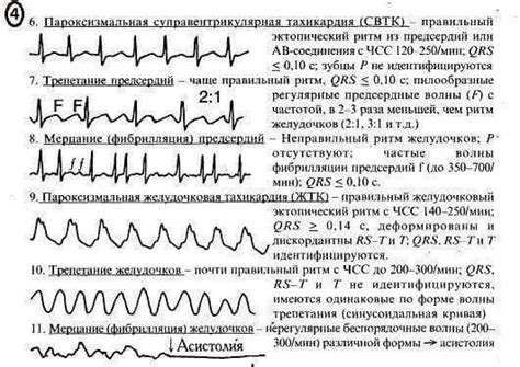 ЭКГ под силу каждому в Украине