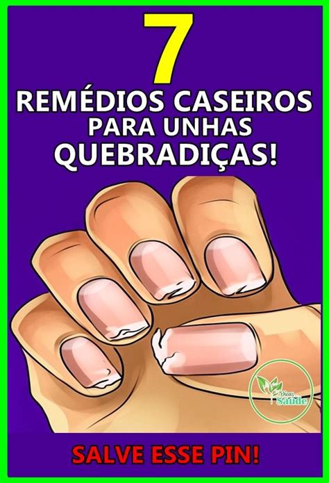 7 Remédios Caseiros Para Unhas Quebradiças Unhas quebradiças Unhas