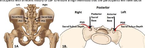 [pdf] Ultrasonographic Evaluation Of The Effect Of Osteopathic Manipulative Treatment On Sacral