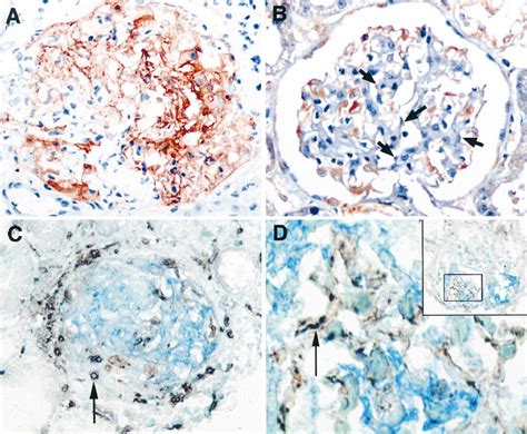 Tissue factor localization by immunohistochemistry. (A) Tissue factor ...