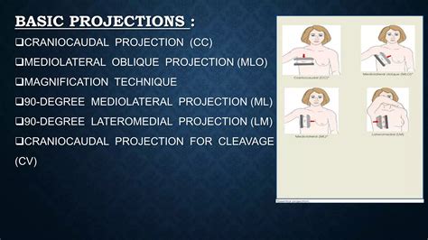 Basic Projections Of Mammogram Pptx