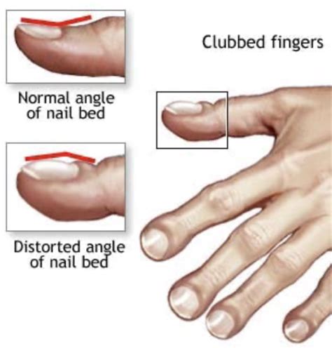 PD Skin Hair And Nails Flashcards Quizlet