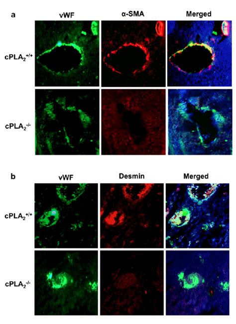 Pericyte coverage of blood vessels in tumors from cPLA 2 α and cPLA