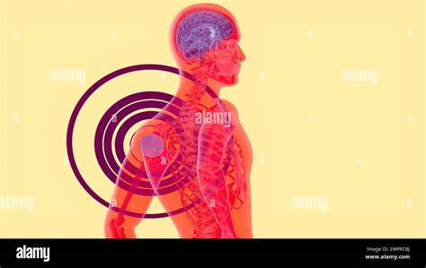 Shoulder Pain Conceptual Illustration Stock Photo Alamy