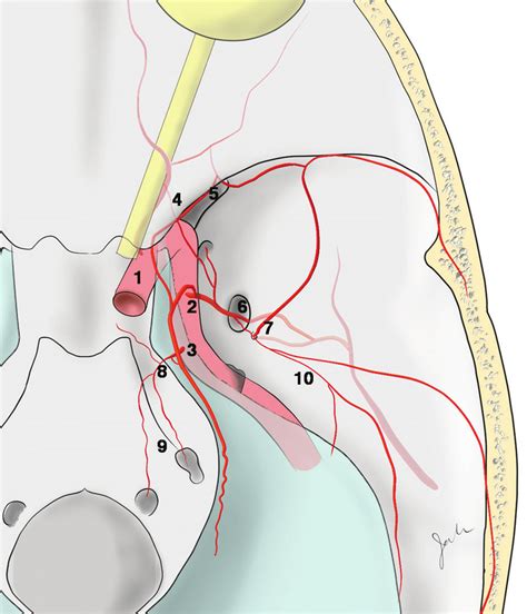 Illustration Of The Arterial Anatomy Of The Right Parasellar Area In