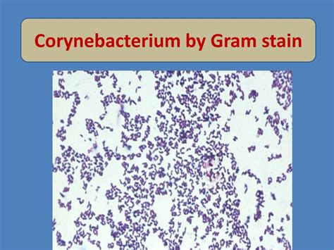 Corynebacterium glucuronolyticum у мужчин в посеве фото