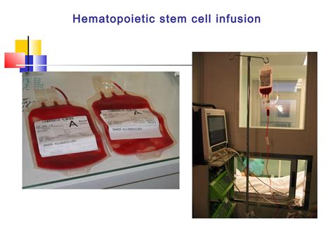 Stem Cell Transplantation Ppt