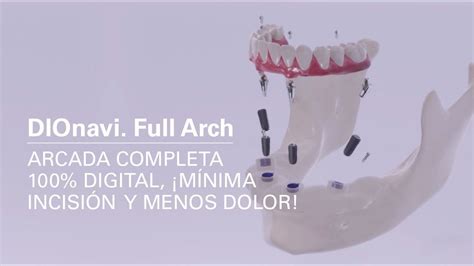 DIOnavi Full Arch YouTube