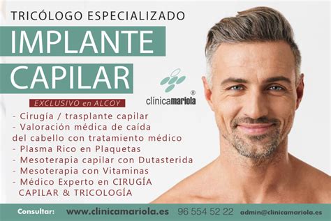 IMPLANTE CAPILAR y TRATAMIENTOS del CABELLO en ALCOY Alcoi Clínica de