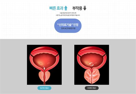 유로리프트 해피비뇨의학과의원