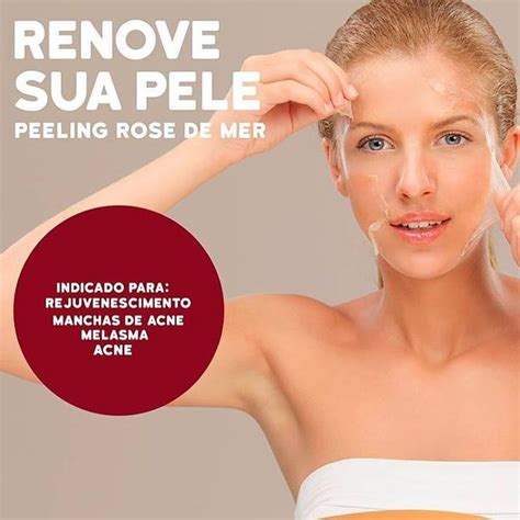 Atenção esteticistas Vocês têm que conhecer o curso Peeling Rose de