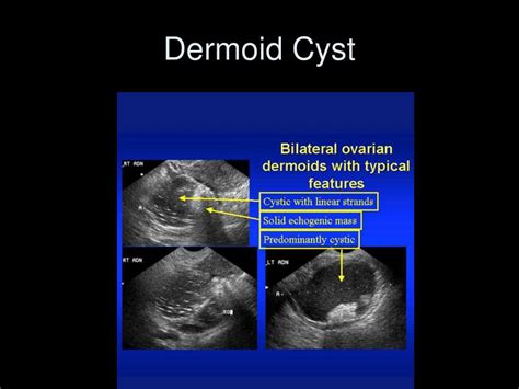 Ppt Female And Male Reproductive System And Hsg And Prostate Imaging