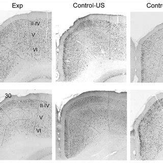 Photomicrographs Showing C Fos Expression In Retrosplenial Areas 29c