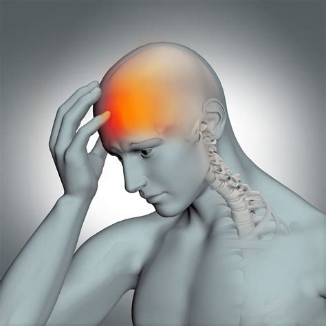 What Is Stump Neuralgia at Hunter Coningham blog