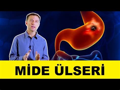 Mide ülserlerinden nasıl kurtulur Peptik ülser tedavisi Dr Berg