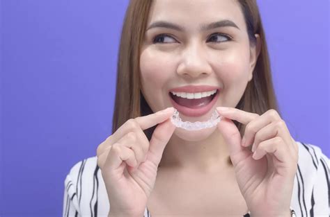 4 Amazing Benefits Of Invisalign You Need To Know