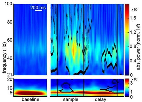 Average time-frequency power of LFP of a single electrode of a single ... 