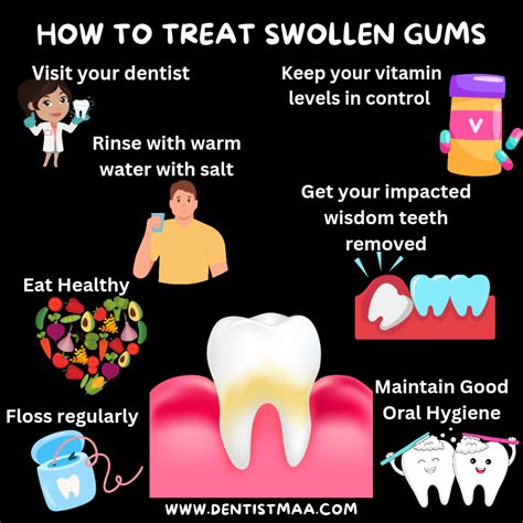 How to treat swollen gums? - DentistMaa