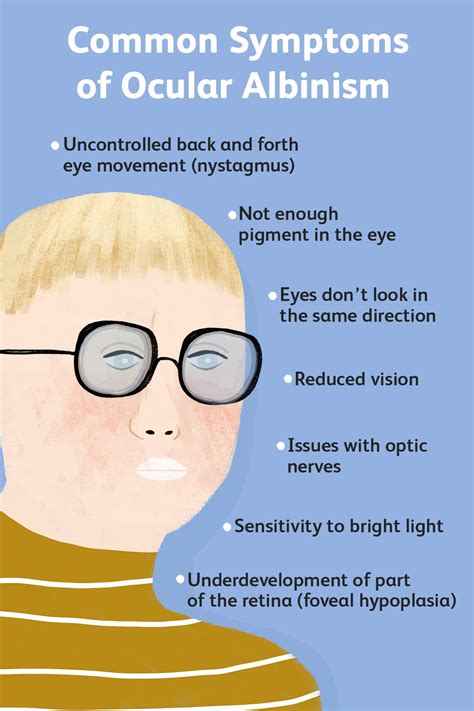 What Is Ocular Albinism?